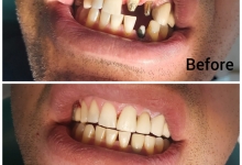 Medic Bun Pitesti Estetica dentara Pitesti - Clinica Dr. Gupta