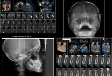 Medic Bun Galati Radiologie Dentara Galati -  SANDENT