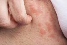 Dermatovenerologie Bucuresti-Sector 1