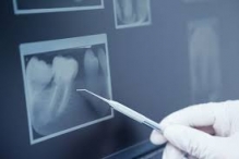 Radiografie Dentara - Radiologie - Imagistica Sibiu