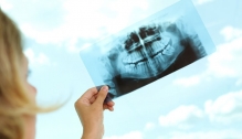 Radiografie Dentara - Radiologie - Imagistica Medias