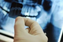 Radiografie Dentara - Radiologie - Imagistica Bucuresti-Sector 4