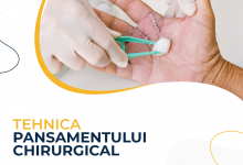Medic Bun Iasi  Chirurgie Generala Iasi - OCHI DOC