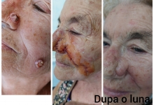 Medic Bun Mioveni  Chirurgie Plastica-Chirurgie Estetica Mioveni - Clinica Dr. Gupta