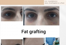 Medic Bun Mioveni  Chirurgie Plastica-Chirurgie Estetica Mioveni - Clinica Dr. Gupta