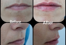 Medic Bun Mioveni  Chirurgie Plastica-Chirurgie Estetica Mioveni - Clinica Dr. Gupta