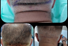 Medic Bun Pitesti  Chirurgie Plastica-Chirurgie Estetica Pitesti - Clinica Dr. Gupta