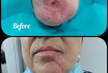 Medic Bun Pitesti  Chirurgie Plastica-Chirurgie Estetica Pitesti - Clinica Dr. Gupta