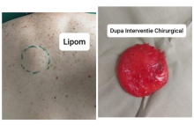 Medic Bun Pitesti  Chirurgie Plastica-Chirurgie Estetica Pitesti - Clinica Dr. Gupta