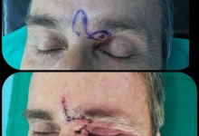 Medic Bun Pitesti  Chirurgie Plastica-Chirurgie Estetica Pitesti - Clinica Dr. Gupta