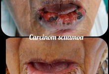 Medic Bun Pitesti  Chirurgie Plastica-Chirurgie Estetica Pitesti - Clinica Dr. Gupta