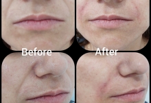 Medic Bun Pitesti  Chirurgie Plastica-Chirurgie Estetica Pitesti - Clinica Dr. Gupta