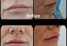 Medic Bun Pitesti  Chirurgie Plastica-Chirurgie Estetica Pitesti - Clinica Dr. Gupta