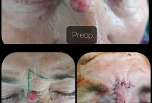 Medic Bun Pitesti  Chirurgie Plastica-Chirurgie Estetica Pitesti - Clinica Dr. Gupta