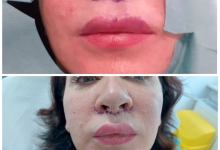 Medic Bun Pitesti  Chirurgie Plastica-Chirurgie Estetica Pitesti - Clinica Dr. Gupta