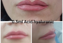 Medic Bun Pitesti  Chirurgie Plastica-Chirurgie Estetica Pitesti - Clinica Dr. Gupta