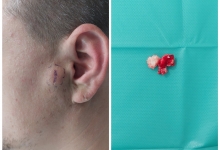 Medic Bun Pitesti  Chirurgie Plastica-Chirurgie Estetica Pitesti - Clinica Dr. Gupta