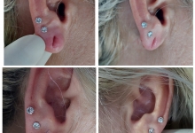 Medic Bun Pitesti  Chirurgie Plastica-Chirurgie Estetica Pitesti - Clinica Dr. Gupta