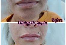 Medic Bun Pitesti  Chirurgie Plastica-Chirurgie Estetica Pitesti - Clinica Dr. Gupta