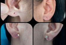 Medic Bun Pitesti  Chirurgie Plastica-Chirurgie Estetica Pitesti - Clinica Dr. Gupta