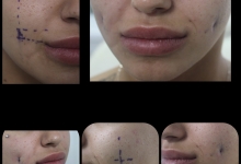 Medic Bun Pitesti  Chirurgie Plastica-Chirurgie Estetica Pitesti - Clinica Dr. Gupta