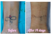 Medic Bun Pitesti  Chirurgie Plastica-Chirurgie Estetica Pitesti - Clinica Dr. Gupta