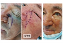 Medic Bun Pitesti  Chirurgie Plastica-Chirurgie Estetica Pitesti - Clinica Dr. Gupta