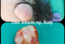 Medic Bun Topoloveni  Chirurgie Plastica Topoloveni - Clinica Dr. Gupta