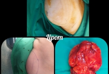 Medic Bun Topoloveni  Chirurgie Plastica Topoloveni - Clinica Dr. Gupta