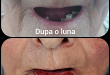 Medic Bun Topoloveni  Chirurgie Plastica Topoloveni - Clinica Dr. Gupta