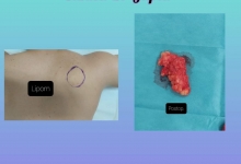 Medic Bun Topoloveni  Chirurgie Plastica Topoloveni - Clinica Dr. Gupta