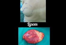 Medic Bun Topoloveni  Chirurgie Plastica Topoloveni - Clinica Dr. Gupta