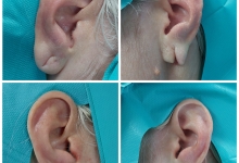 Medic Bun Topoloveni  Chirurgie Plastica Topoloveni - Clinica Dr. Gupta