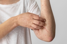 Medic Bun Bucuresti-Sector 5 Cabinet Dermatologie Sector 5