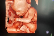 Medic Bun Pascani Cabinet Obstetrica-Ginecologie Pascani Dr. Sava Tamara