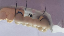 Medic Bun Saftica Cabinet Stomatologic  Otopeni Happy Smile - Dr. Cotrut Gratiela