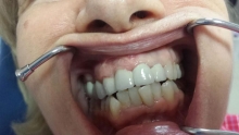 Medic Bun Saftica Cabinet Stomatologic  Otopeni Happy Smile - Dr. Cotrut Gratiela