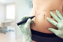 Medic Bun Galati Chirurgie Plastica Galati