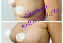 Medic Bun Targoviste Chirurgie plastica & Med Spa Targoviste - Dr. Wood Ruxandra Pascanu