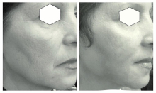 Medic Bun Targoviste Chirurgie plastica & Med Spa Targoviste - Dr. Wood Ruxandra Pascanu