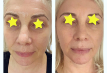 Medic Bun Targoviste Chirurgie plastica & Med Spa Targoviste - Dr. Wood Ruxandra Pascanu