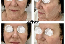 Medic Bun Targoviste Chirurgie plastica & Med Spa Targoviste - Dr. Wood Ruxandra Pascanu