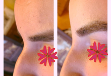 Medic Bun Targoviste Chirurgie plastica & Med Spa Targoviste - Dr. Wood Ruxandra Pascanu