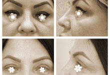 Medic Bun Targoviste Chirurgie plastica & Med Spa Targoviste - Dr. Wood Ruxandra Pascanu