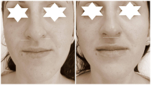 Medic Bun Targoviste Chirurgie plastica & Med Spa Targoviste - Dr. Wood Ruxandra Pascanu