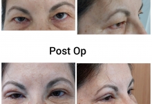 Medic Bun Campulung Muscel Chirurgie plastica Campulung Muscel - Clinica Dr. Gupta