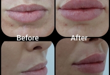 Medic Bun Campulung Muscel Chirurgie plastica Campulung Muscel - Clinica Dr. Gupta