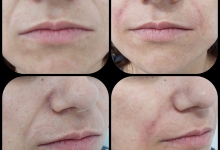 Medic Bun Campulung Muscel Chirurgie plastica Campulung Muscel - Clinica Dr. Gupta