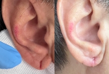 Medic Bun Gheorgheni Dr. Adelina Pop - Chirurgie Plastica, Estetica si Microchirurgie Reconstructiva
