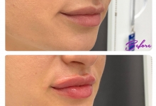 Medic Bun Gheorgheni Dr. Adelina Pop - Chirurgie Plastica, Estetica si Microchirurgie Reconstructiva